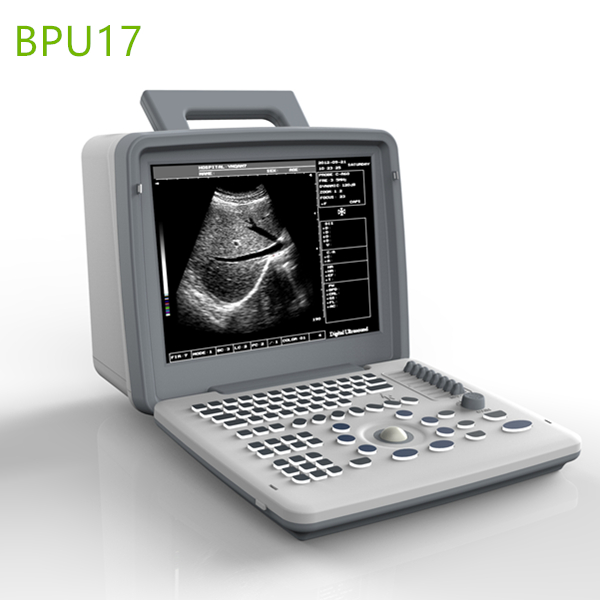 Portable Ultrasound Machines for Home or Clinic Use