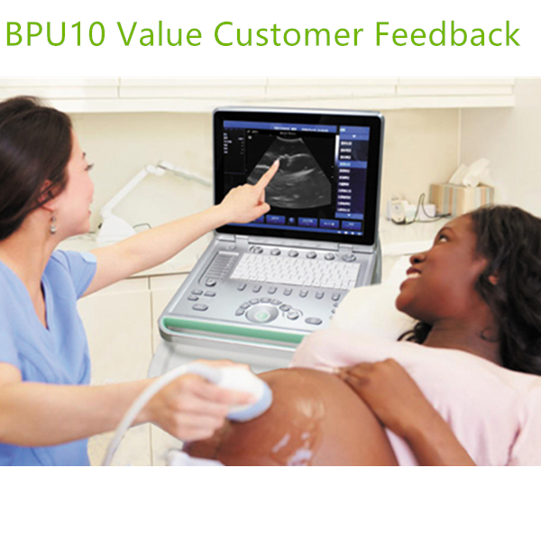 Ultrasound Echo Machines ARM Base and Portable with light weight
