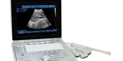 3D laptop ultrasound machines,portable ultrasound scanner,laptop echo machines,medical scan machines,usg ,ultrasound machine price.