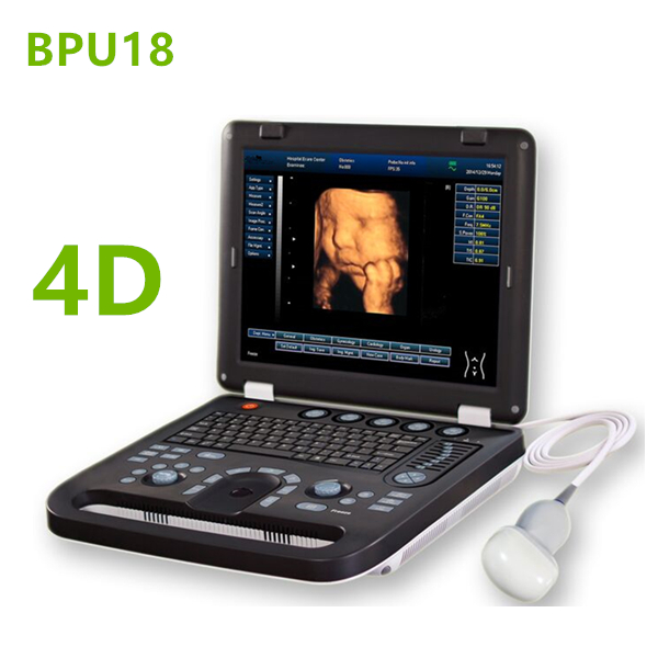 laptop ultrasound machines,3D ultrasound machines,4Dultrasound machines,4D Laptop ultrasound machines,4D echo machines,4D Usg ,4D low price ultrasound scanner ,Cheap Ultrasound machines