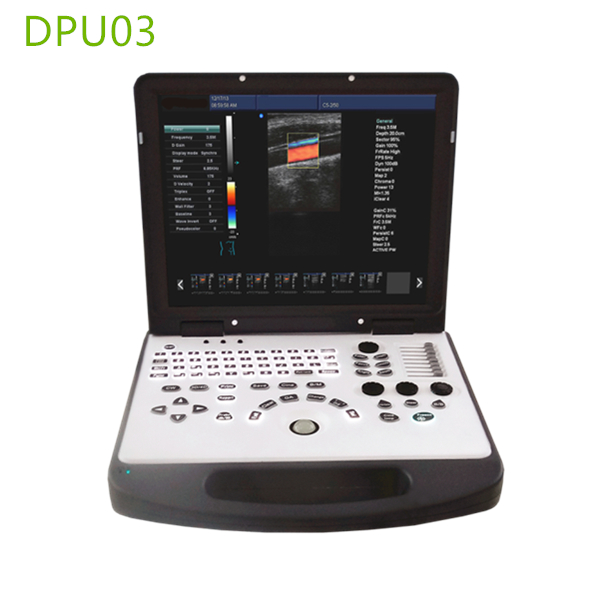 doppler ultrasound machines,color ultrasound machines,portable doppler echo machines ,ultrasound scan machines,doppler portable ultrasound machine,cheap color ultrasound machines