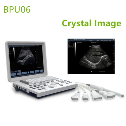 portable ultrasound machines,portable ultrasound machine price,used portable ultrasound machine,best laptop ultrasound machine,portable ultrasound factory sell directly,price from medical ultrasound,Laptop medical scan machines