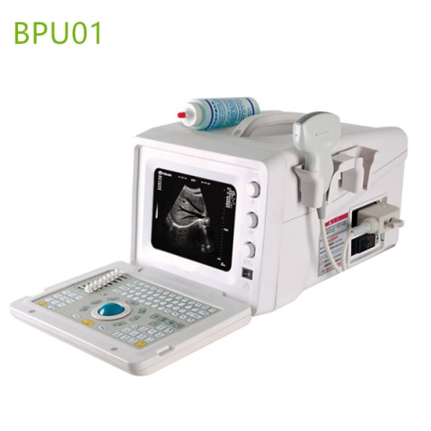 low price portable ultrasound machine,cheap ultrasound scanner