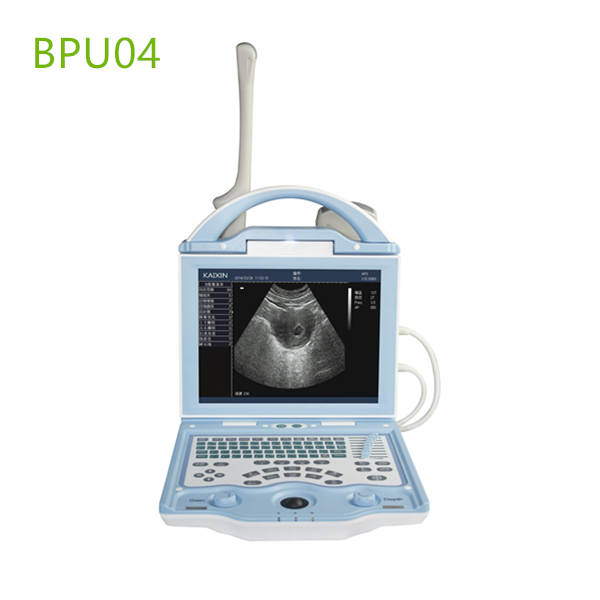portable ultrasound machines,portable ultrasound machine price,used portable ultrasound machine,best laptop ultrasound machine,portable ultrasound factory sell directly,price from medical ultrasound,medical scan machines