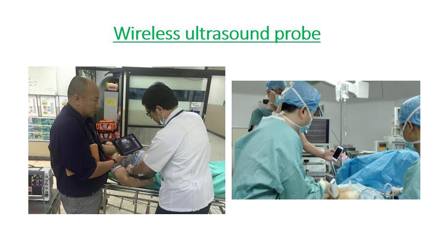 wireless ultrasound probe ultrasound transducer