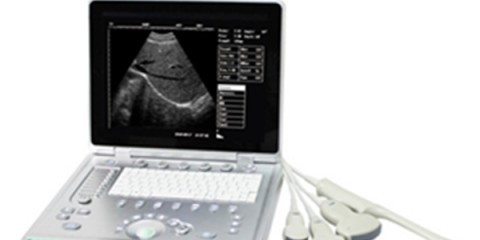 laptop ultrasound machines,portable ultrasound scanner,laptop echo machines,medical scan machines,usg ,ultrasound machine price