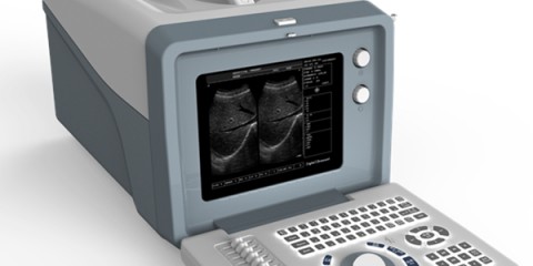 Laptop ultrasound machine,Laptop ultrasound machine price,used Laptop ultrasound machine,best laptop ultrasound machine,laptop ultrasound factory sell directly,price from medical ultrasound