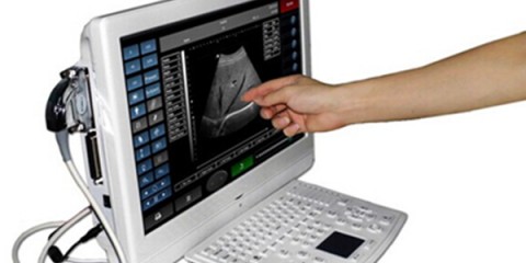 Touchscreen ultrasound machines,portable ultrasound scanner,laptop echo machines,medical scan machines,usg ,ultrasound machine price.