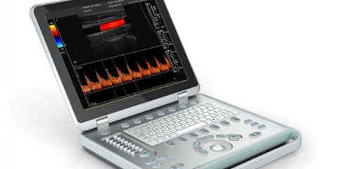 doppler ultrasound echo machines,used doppler ultrasound machines,doppler ultrasound scanner,doppler medical scan machines,doppler ultrasound machines,4d laptop ultrasound machines,portable ultrasound 4d