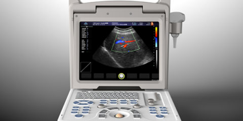 doppler ultrasound echo machines,used doppler ultrasound machines,doppler ultrasound scanner,doppler medical scan machines,doppler ultrasound machines,4d laptop ultrasound machines,portable ultrasound